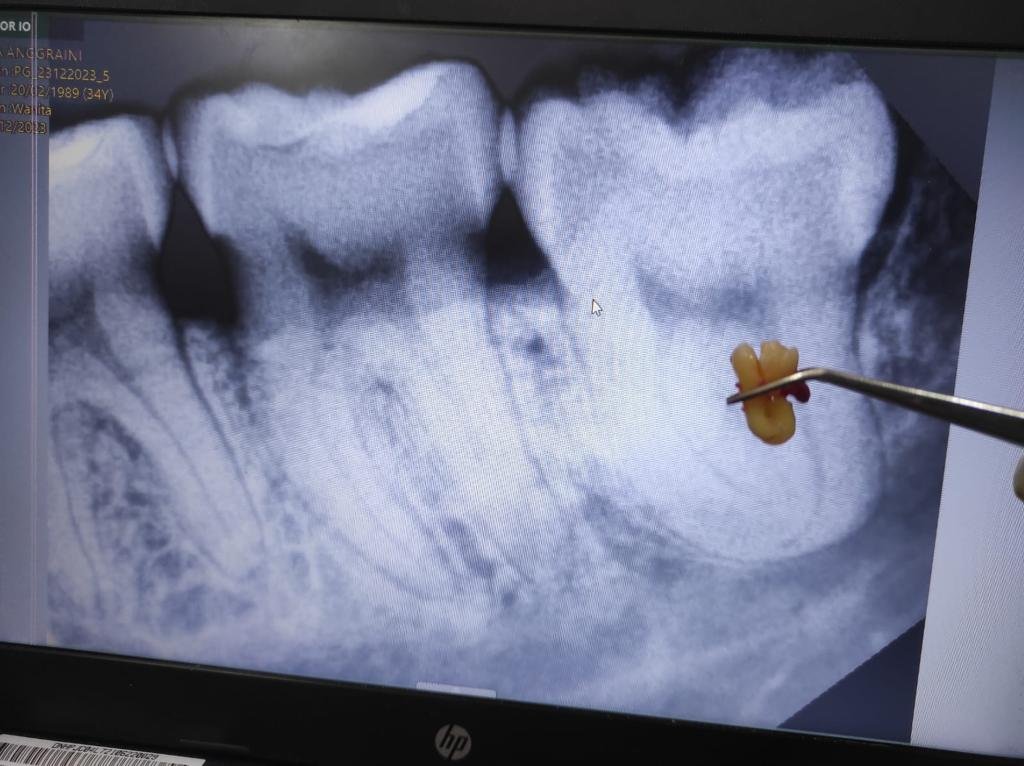 Ruang perawatan modern di Klinik Pondok Gigi Jakarta