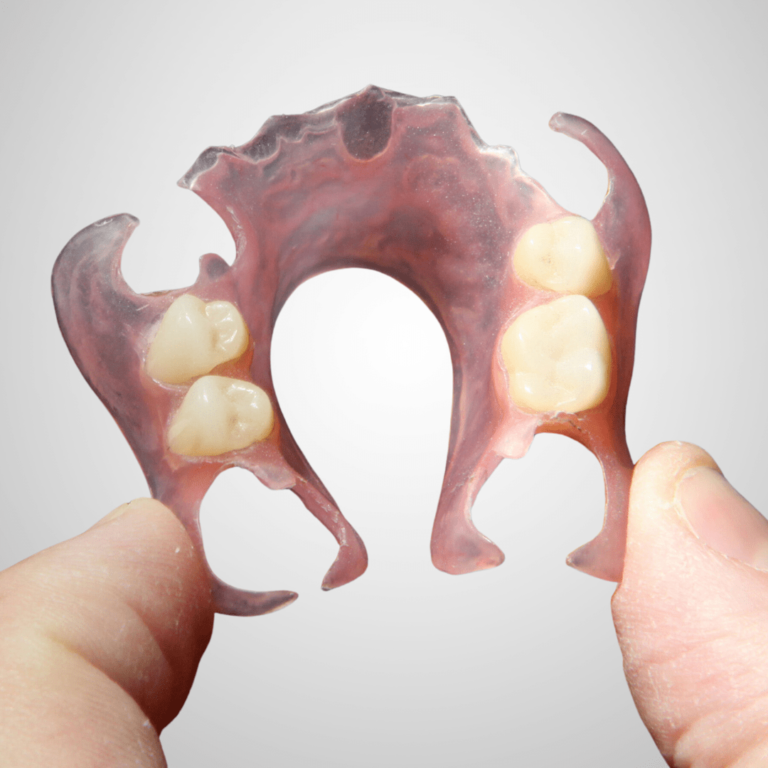 gigi palsu akrilik merupakan gigi palsu yang kuat