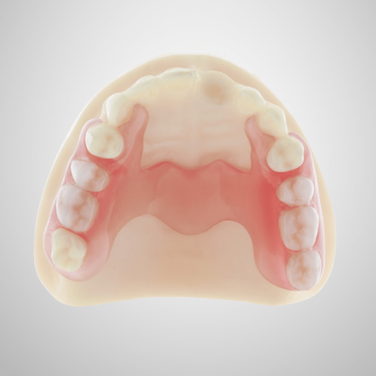 gigi palsu thermosens merupakan gigi palsu fleksibel yang nyaman