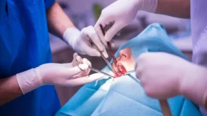 Operasi Gigi Bungsu Jakarta Selatan Di Klinik Pondok Gigi