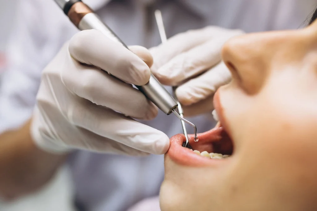 Dokter melakukan scaling gigi menggunakan alat ultrasonik di klinik Pondok Gigi Jakarta Selatan