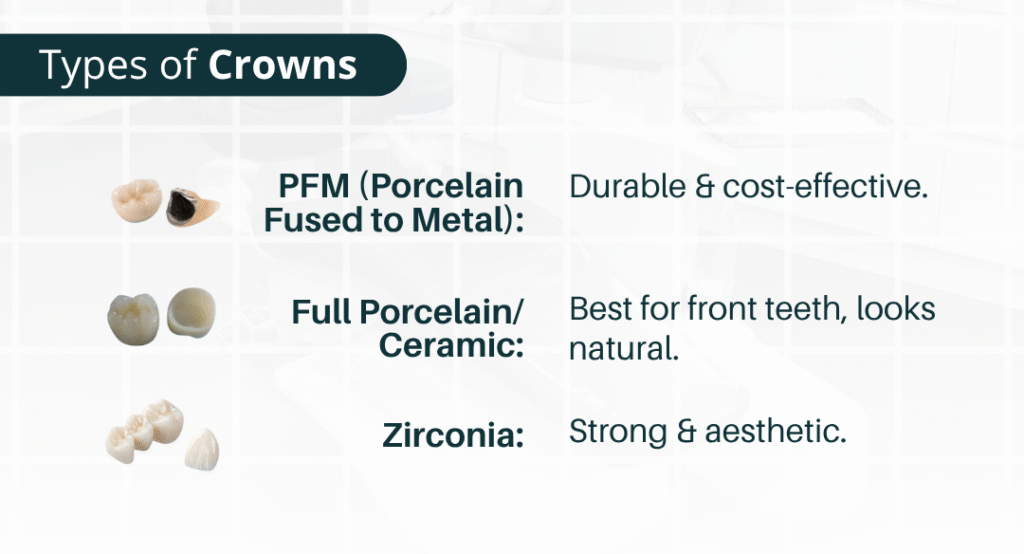 Ilustrasi edukatid jenis-jenis crown gigi: porselen, zirconia, logam dan kombinasi