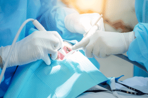 Prosedur odontektomi gigi bungsu di jakarta