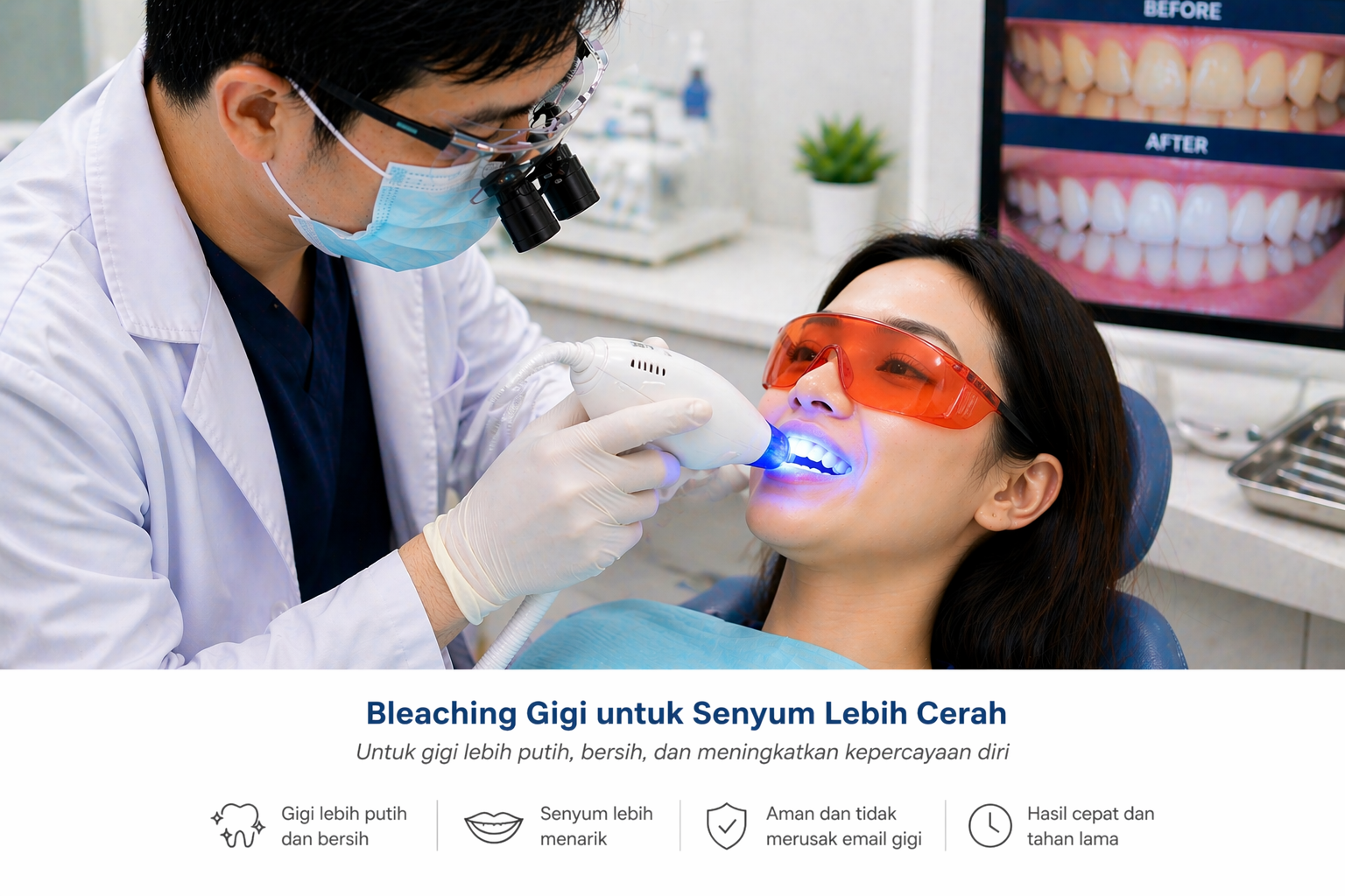 Perawatan bleaching gigi di Klinik Gigi Antasari